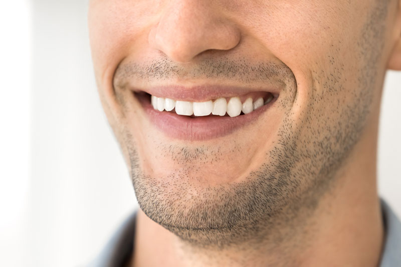 Close-up of a smiling man showing straight white teeth and stubble on his face.