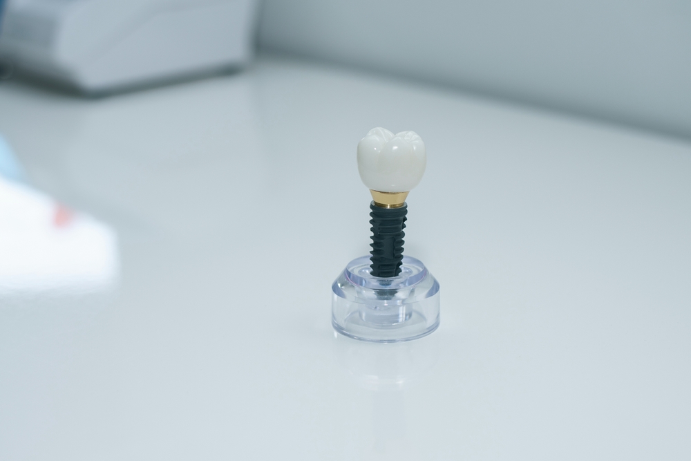 Dental consultation about bone grafting procedure in a modern office