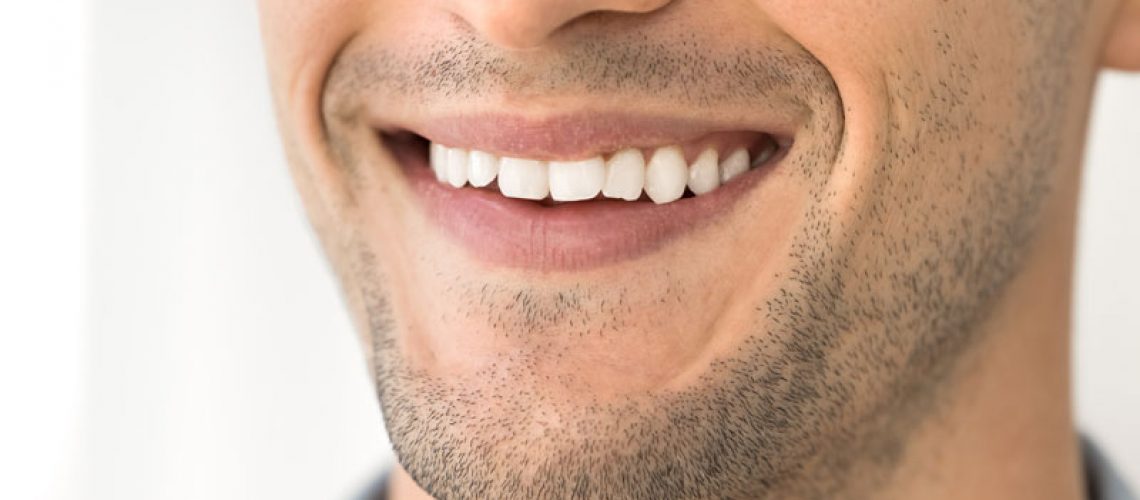 Close-up of a smiling man showing straight white teeth and stubble on his face.