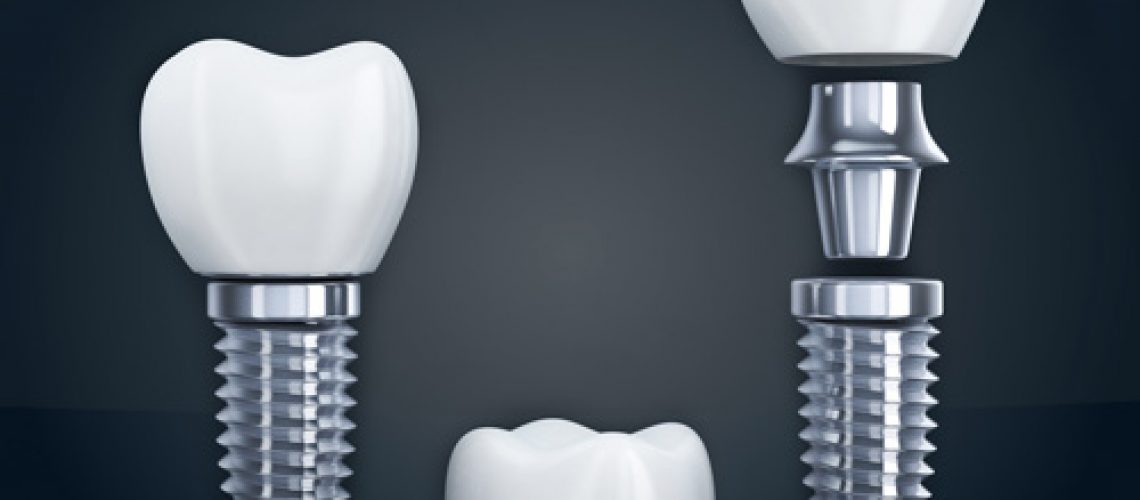 the three different parts that make up a dental implant