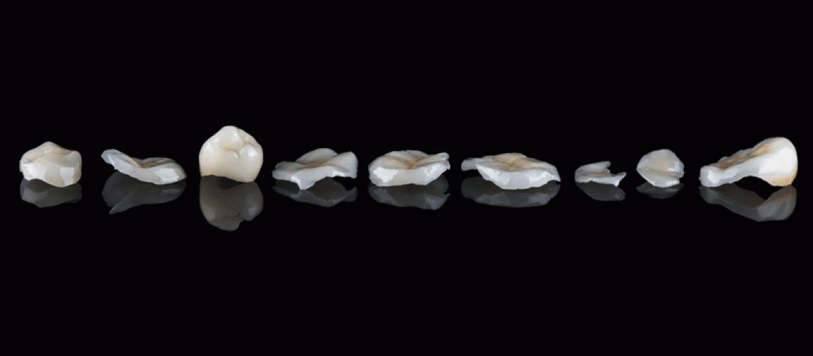 dental crowns laying on black reflective glass